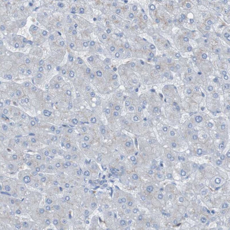 KIAA1024 Antibody - BSA Free Immunohistochemistry: KIAA1024 Antibody - BSA Free [NBP1-90947]