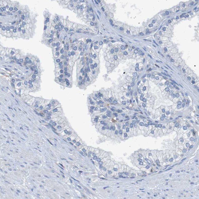 KIAA1024 Antibody - BSA Free Immunohistochemistry: KIAA1024 Antibody - BSA Free [NBP1-90947]