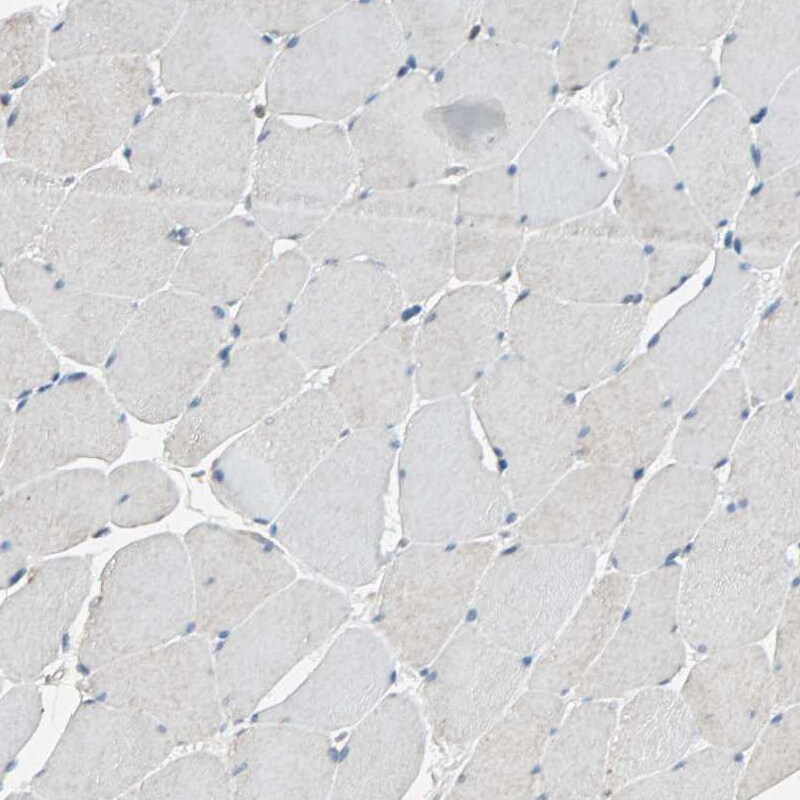 MLK4 Antibody - BSA Free Immunohistochemistry: MLK4 Antibody - BSA Free [NBP1-90950]