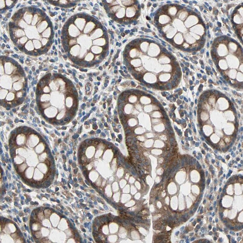MLK4 Antibody - BSA Free Immunohistochemistry: MLK4 Antibody - BSA Free [NBP1-90950]