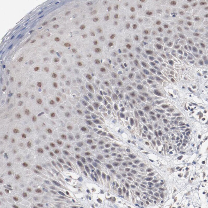 ERICH1 Antibody - BSA Free Immunohistochemistry: ERICH1 Antibody - BSA Free [NBP1-90952]