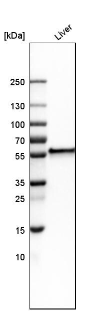 Fibrinogen beta chain Antibody - BSA Free Western Blot: Fibrinogen beta chain Antibody - BSA Free [NBP1-90956]
