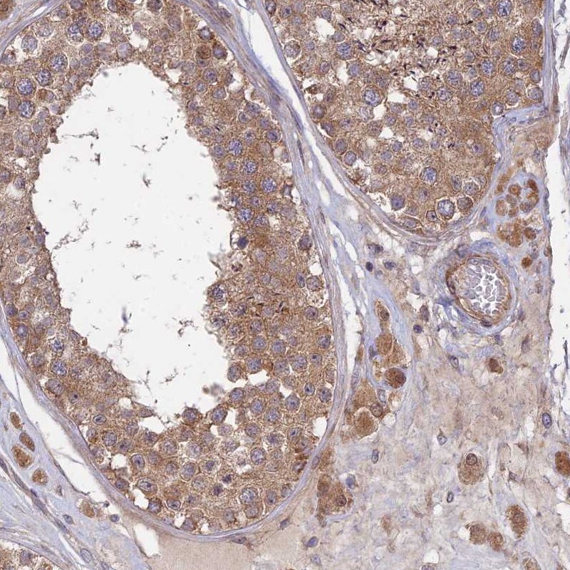 INCA1 Antibody - BSA Free Immunohistochemistry: INCA1 Antibody - BSA Free [NBP1-90960]