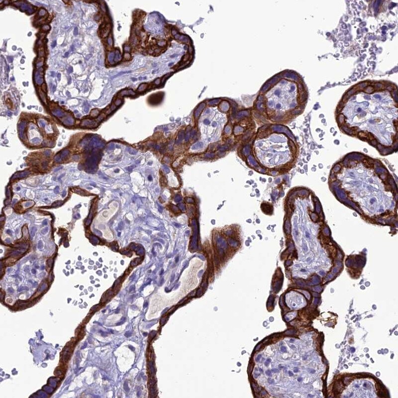 C20orf202 Antibody - BSA Free Immunohistochemistry: C20orf202 Antibody - BSA Free [NBP1-90964]