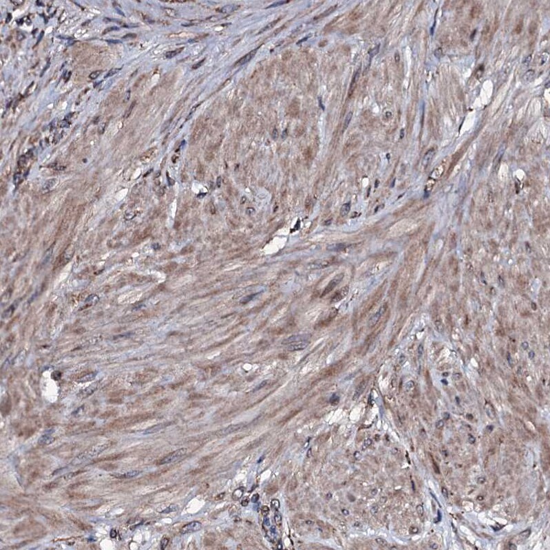 RAB12 Antibody - BSA Free Immunohistochemistry: RAB12 Antibody - BSA Free [NBP1-90976]