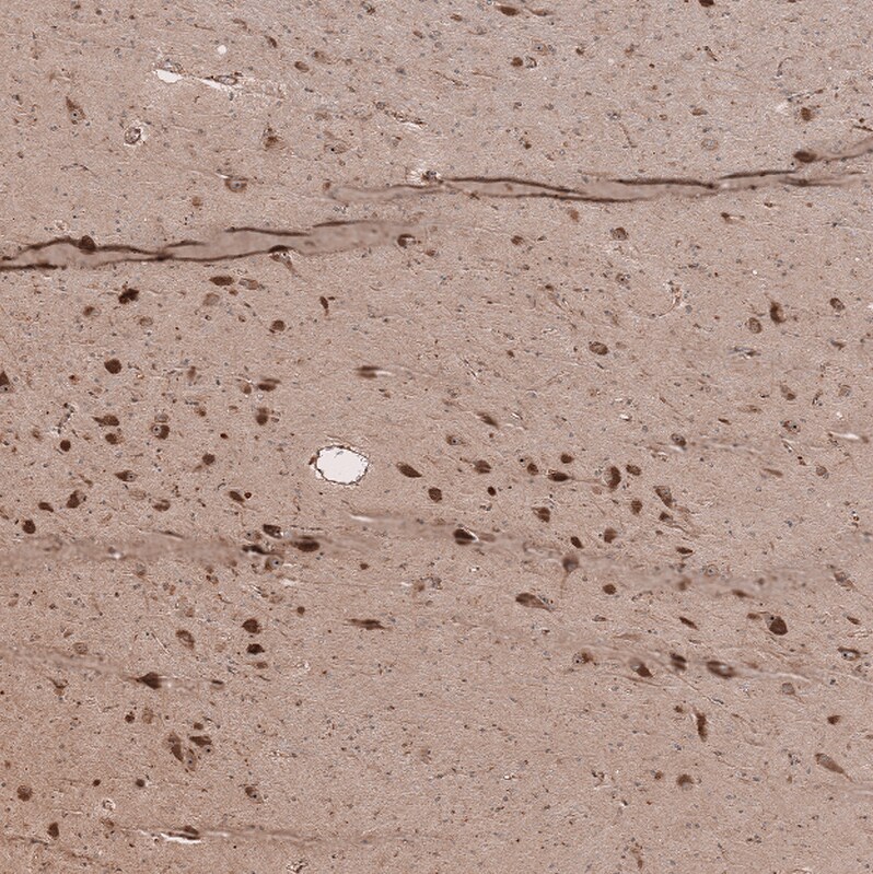 SELT Antibody - BSA Free Immunohistochemistry: SELT Antibody - BSA Free [NBP1-90979]