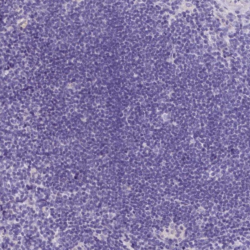 INSC Antibody - BSA Free Immunohistochemistry: INSC Antibody - BSA Free [NBP1-90980]