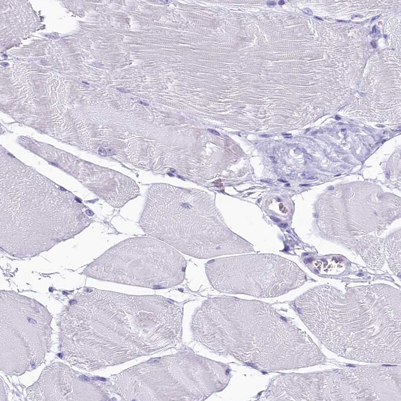 INSC Antibody - BSA Free Immunohistochemistry: INSC Antibody - BSA Free [NBP1-90980]
