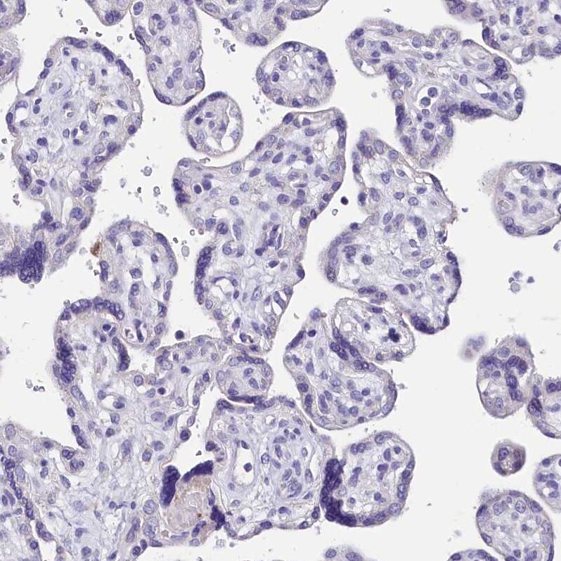 INSC Antibody - BSA Free Immunohistochemistry: INSC Antibody - BSA Free [NBP1-90980]