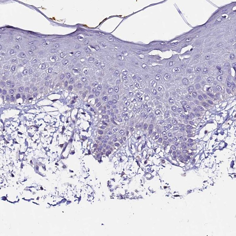 FAM155A Antibody - BSA Free Immunohistochemistry: FAM155A Antibody - BSA Free [NBP1-90982]