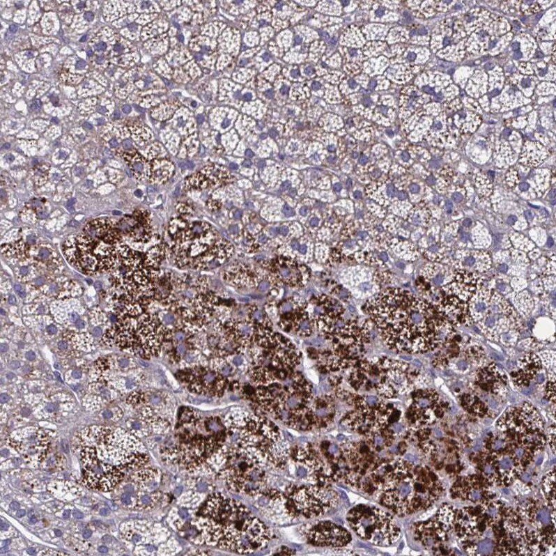 LRRC38 Antibody - BSA Free Immunohistochemistry: LRRC38 Antibody - BSA Free [NBP1-90986]