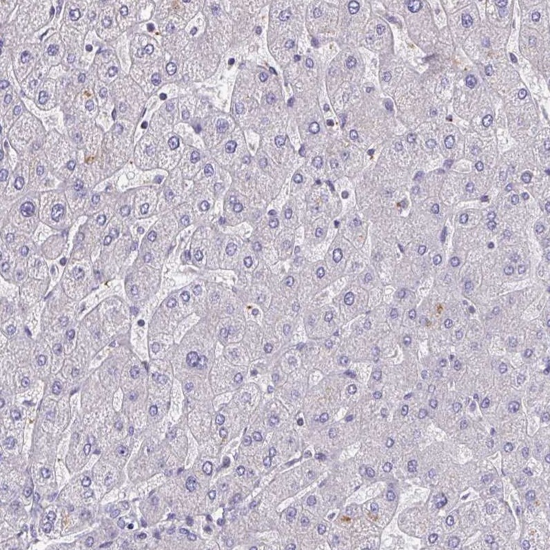 LRRC38 Antibody - BSA Free Immunohistochemistry: LRRC38 Antibody - BSA Free [NBP1-90986]