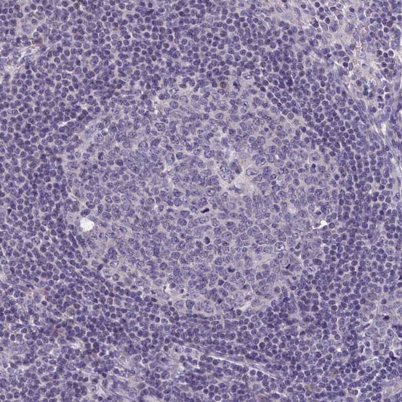 LRRC38 Antibody - BSA Free Immunohistochemistry: LRRC38 Antibody - BSA Free [NBP1-90986]