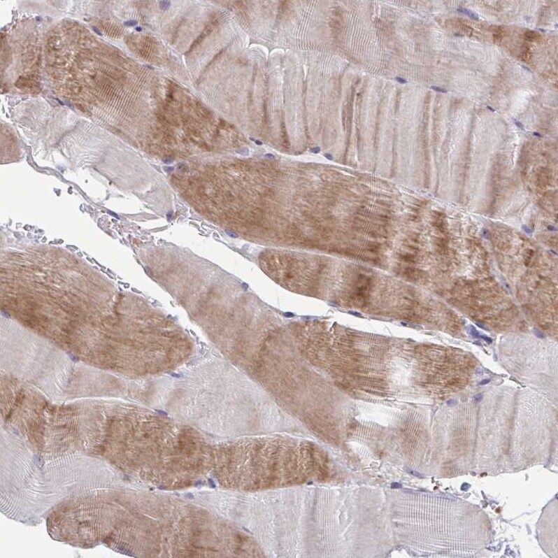 LRRC38 Antibody - BSA Free Immunohistochemistry: LRRC38 Antibody - BSA Free [NBP1-90986]