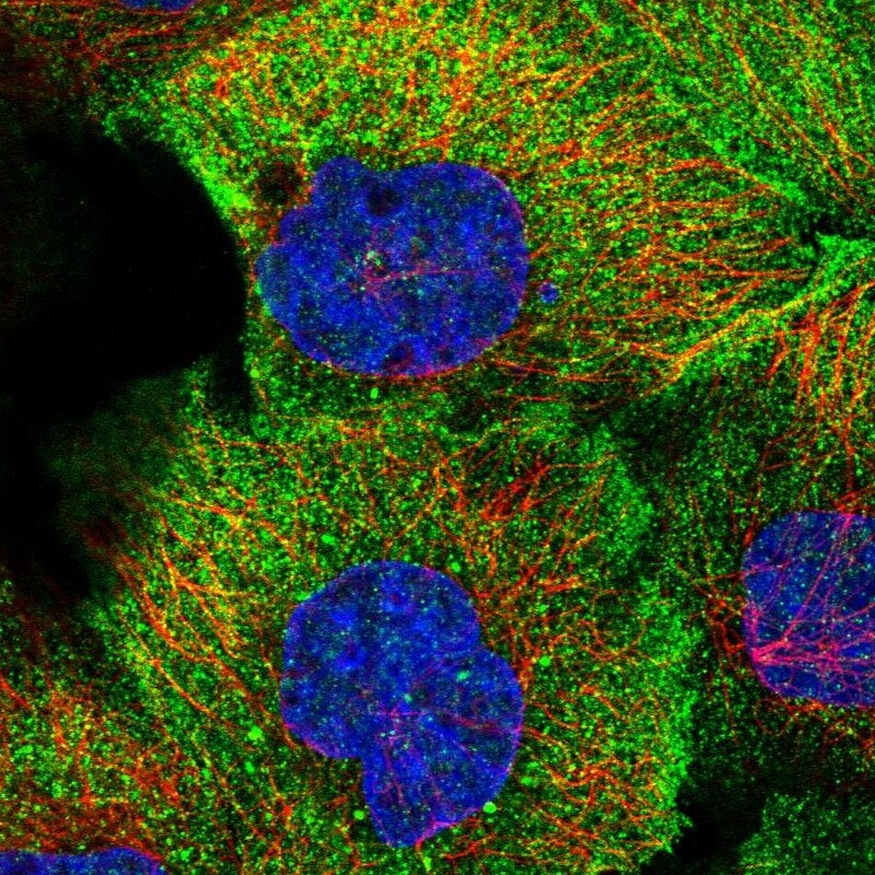 TMEM218 Antibody - BSA Free Immunocytochemistry/ Immunofluorescence: TMEM218 Antibody [NBP1-90988]