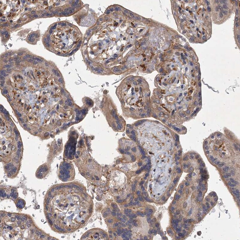 MEPE/OF45 Antibody - BSA Free Immunohistochemistry: MEPE/OF45 Antibody - BSA Free [NBP1-90993]
