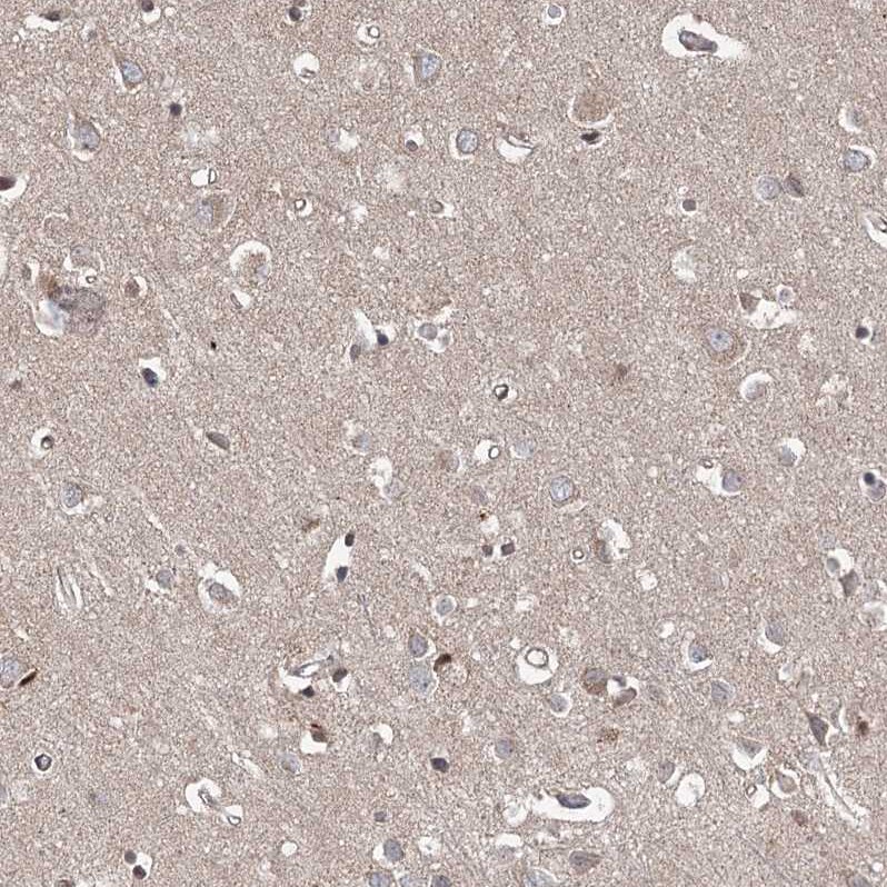 MEPE/OF45 Antibody - BSA Free Immunohistochemistry: MEPE/OF45 Antibody - BSA Free [NBP1-90993]
