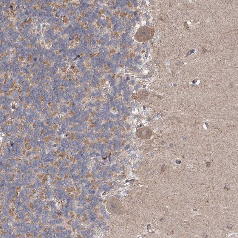 MEPE/OF45 Antibody - BSA Free Immunohistochemistry: MEPE/OF45 Antibody - BSA Free [NBP1-90993]