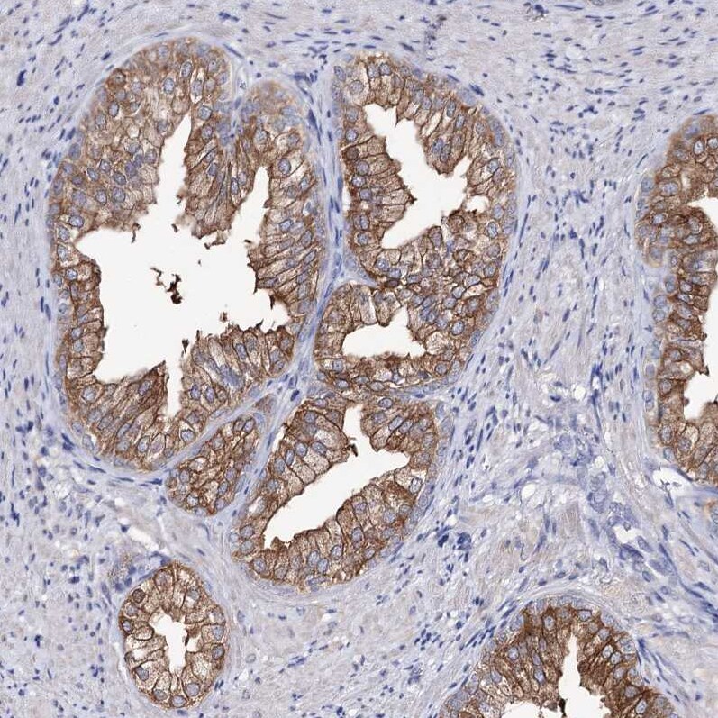 UDP glucose dehydrogenase Antibody - BSA Free Immunohistochemistry: UDP glucose dehydrogenase Antibody - BSA Free [NBP1-90997]