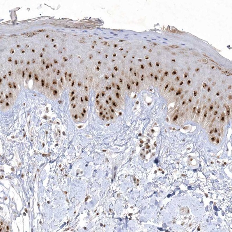 Nucleoplasmin-3 Antibody - BSA Free Immunohistochemistry-Paraffin: Nucleoplasmin-3 Antibody [NBP1-90999]