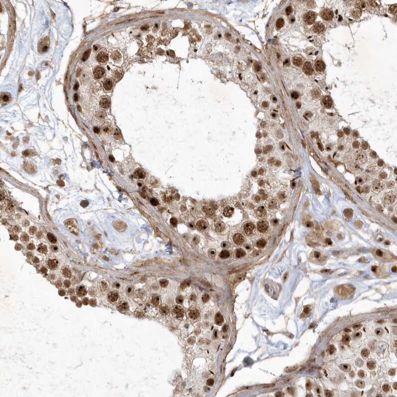 Nucleoplasmin-3 Antibody - BSA Free Immunohistochemistry-Paraffin: Nucleoplasmin-3 Antibody [NBP1-90999]