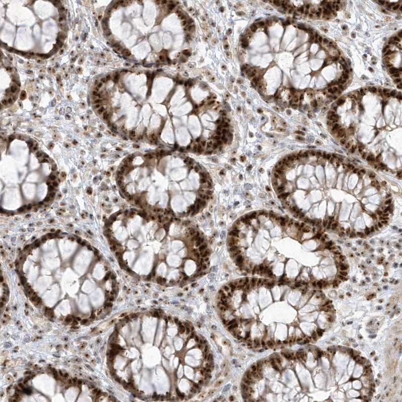 Nucleoplasmin-3 Antibody - BSA Free Immunohistochemistry-Paraffin: Nucleoplasmin-3 Antibody [NBP1-90999]