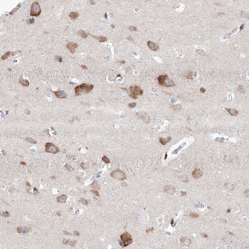 GABA-A R gamma 1 Antibody - BSA Free Immunohistochemistry: GABA-A R gamma 1 Antibody - BSA Free [NBP1-91003]