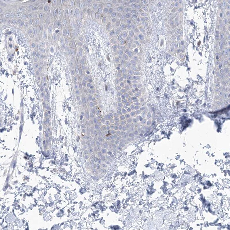 GABA-A R gamma 1 Antibody - BSA Free Immunohistochemistry: GABA-A R gamma 1 Antibody - BSA Free [NBP1-91003]