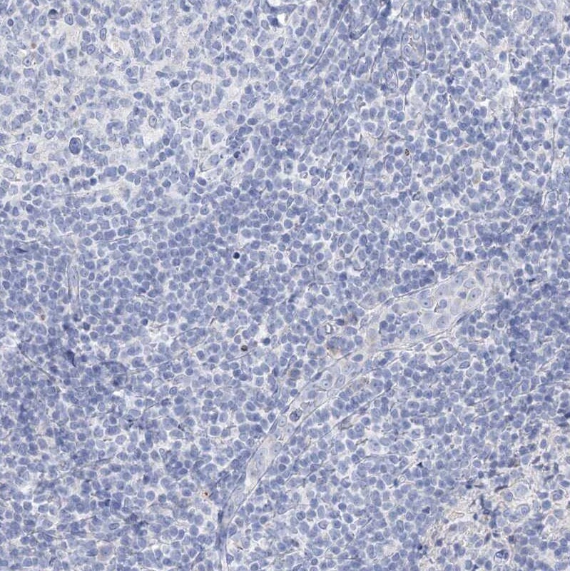GABA-A R gamma 1 Antibody - BSA Free Immunohistochemistry: GABA-A R gamma 1 Antibody - BSA Free [NBP1-91003]