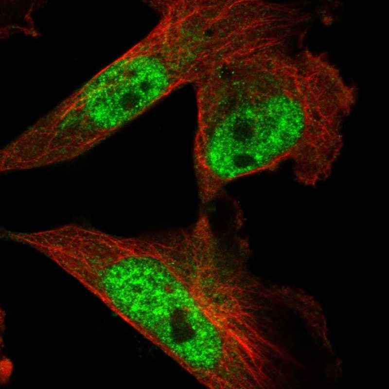 KIAA0556 Antibody - BSA Free Immunocytochemistry/ Immunofluorescence: KIAA0556 Antibody [NBP1-91006]