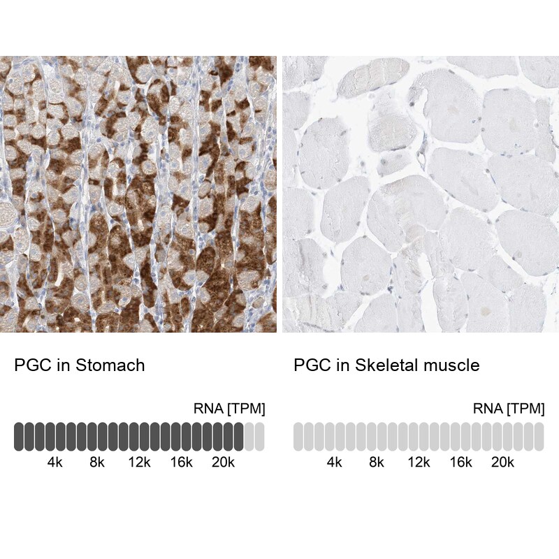 Pepsinogen C/PGC/Progastricsin Antibody - BSA Free Immunohistochemistry-Paraffin: Pepsinogen C/PGC/Progastricsin Antibody [NBP1-91011]