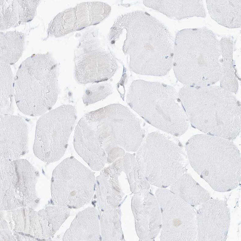Pepsinogen C/PGC/Progastricsin Antibody - BSA Free Immunohistochemistry-Paraffin: Pepsinogen C/PGC/Progastricsin Antibody [NBP1-91011]