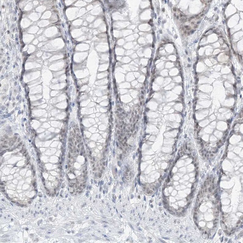 Pepsinogen C/PGC/Progastricsin Antibody - BSA Free Immunohistochemistry-Paraffin: Pepsinogen C/PGC/Progastricsin Antibody [NBP1-91011]
