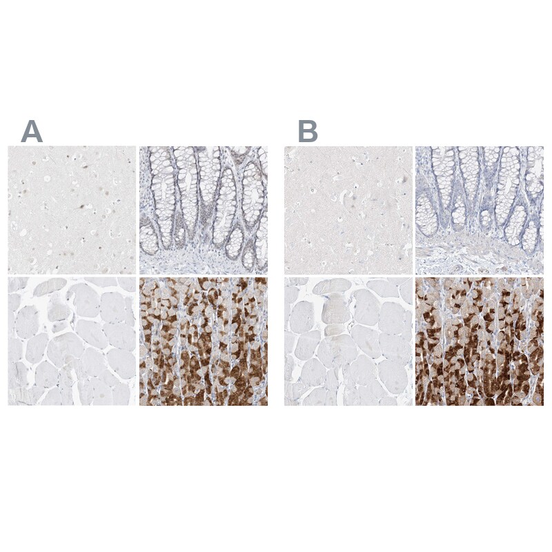 Pepsinogen C/PGC/Progastricsin Antibody - BSA Free Immunohistochemistry-Paraffin: Pepsinogen C/PGC/Progastricsin Antibody [NBP1-91011]