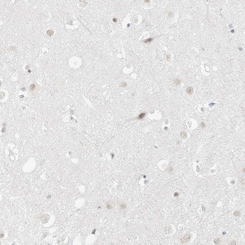 Pepsinogen C/PGC/Progastricsin Antibody - BSA Free Immunohistochemistry: Pepsinogen C/PGC/Progastricsin Antibody - BSA Free [NBP1-91011]