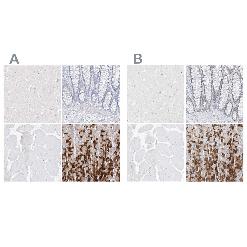 Pepsinogen C/PGC/Progastricsin Antibody - BSA Free Immunohistochemistry-Paraffin: Pepsinogen C/PGC/Progastricsin Antibody [NBP1-91012]