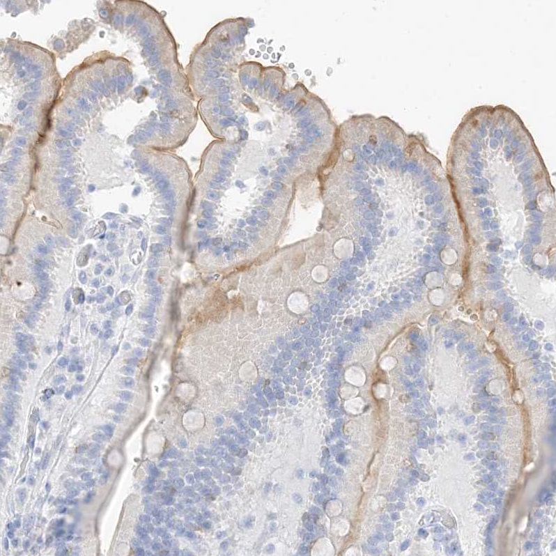 MUC17 Antibody - BSA Free Immunohistochemistry: MUC17 Antibody - BSA Free [NBP1-91013]