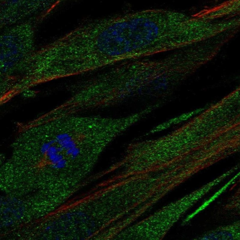 Collagen XXI Antibody - BSA Free Immunocytochemistry/ Immunofluorescence: Collagen XXI Antibody - BSA Free [NBP1-91015]