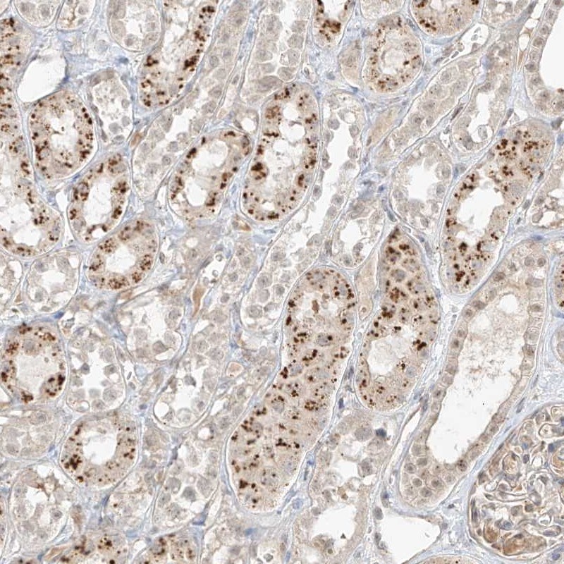 N4BP3 Antibody - BSA Free Immunohistochemistry-Paraffin: N4BP3 Antibody [NBP1-91019]