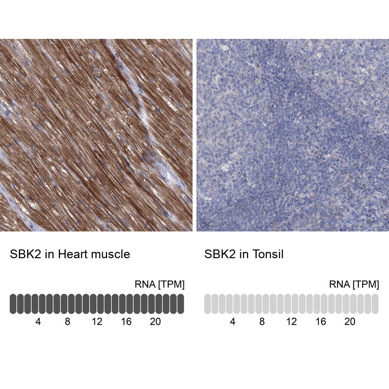 SBK2 Antibody - BSA Free Immunohistochemistry: SBK2 Antibody - BSA Free [NBP1-91020]