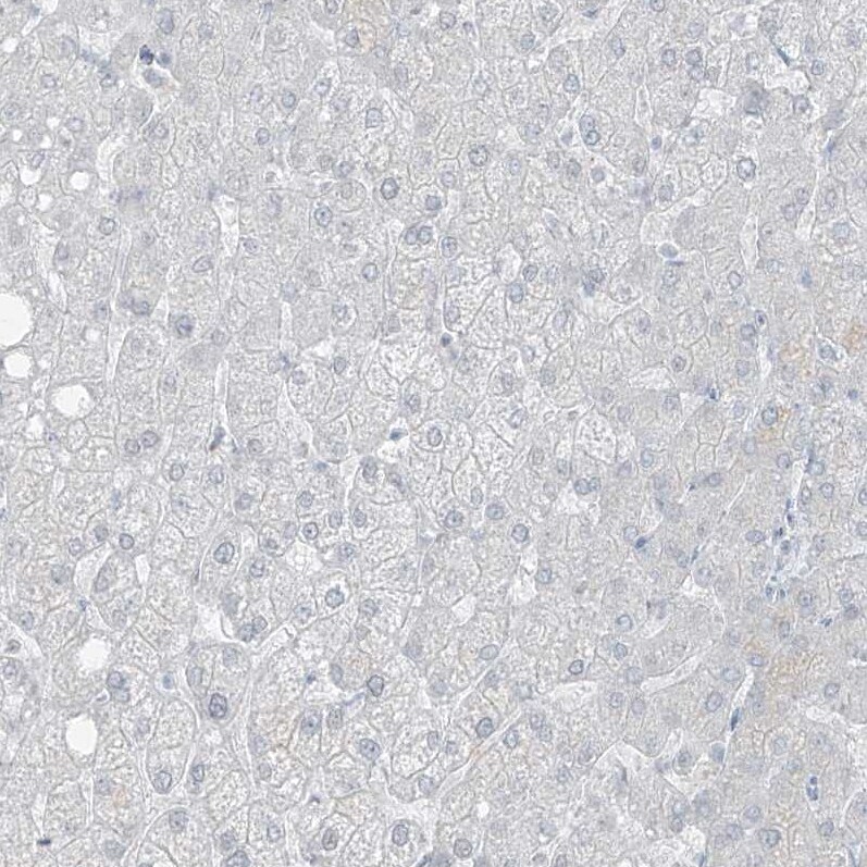 PRDM6 Antibody - BSA Free Immunohistochemistry: PRDM6 Antibody - BSA Free [NBP1-91022]