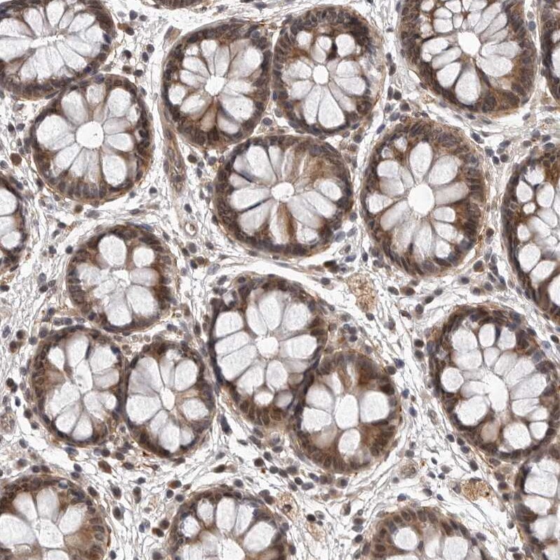 KIAA1614 Antibody - BSA Free Immunohistochemistry: KIAA1614 Antibody - BSA Free [NBP1-91038]