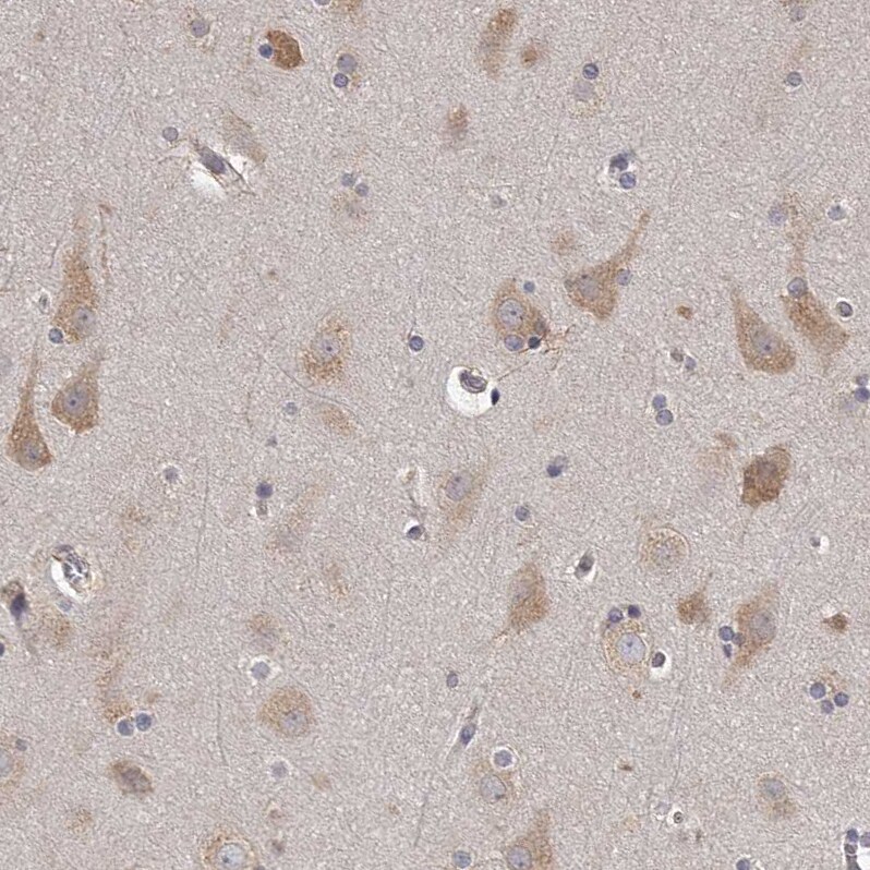 TNN Antibody - BSA Free Immunohistochemistry: TNN Antibody - BSA Free [NBP1-91048]