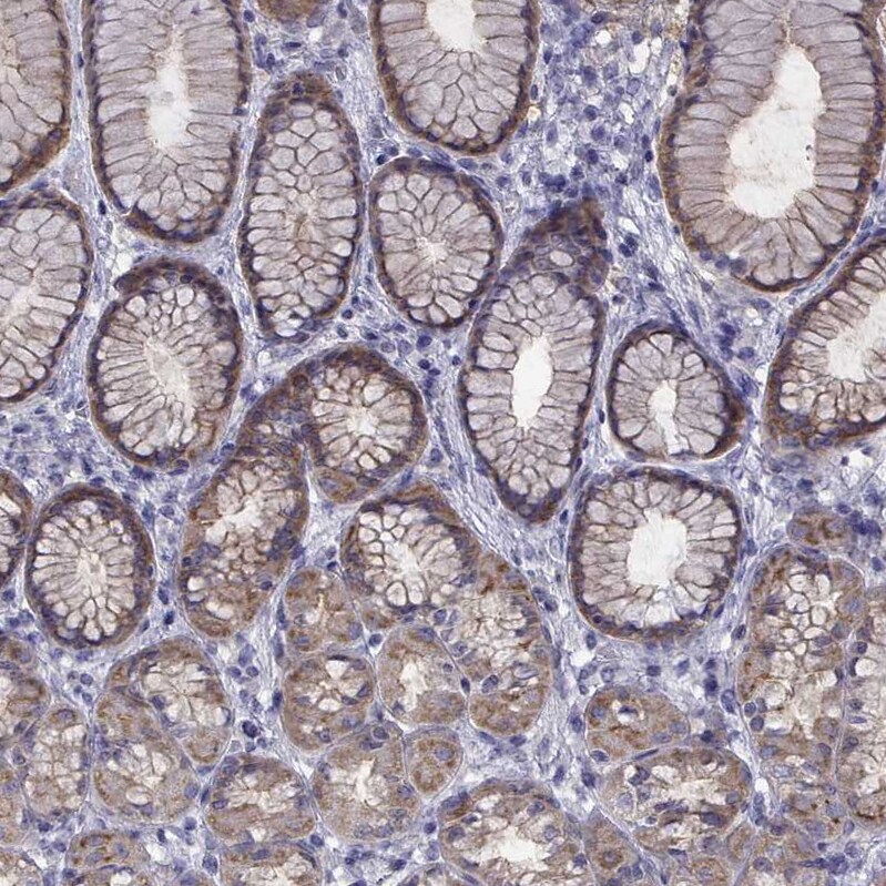 COL22A1 Antibody - BSA Free Immunohistochemistry: COL22A1 Antibody - BSA Free [NBP1-91056]