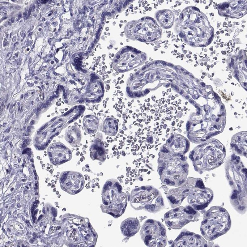 COL22A1 Antibody - BSA Free Immunohistochemistry: COL22A1 Antibody - BSA Free [NBP1-91056]