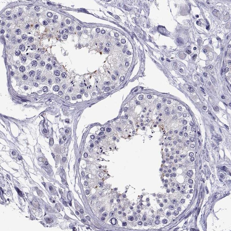 COL22A1 Antibody - BSA Free Immunohistochemistry: COL22A1 Antibody - BSA Free [NBP1-91056]