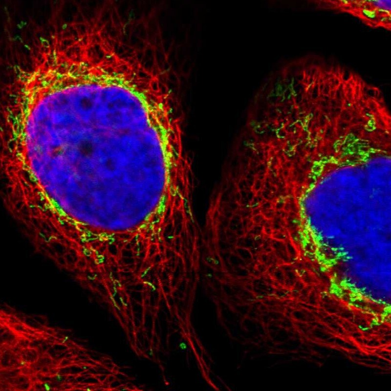 ZNF862 Antibody - BSA Free Immunocytochemistry/ Immunofluorescence: ZNF862 Antibody [NBP1-91062]