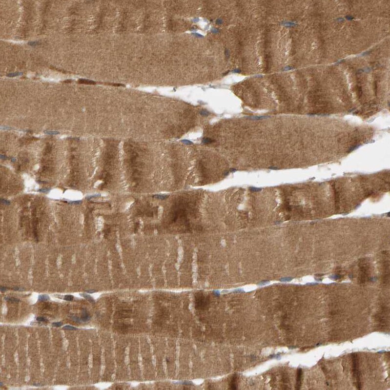 BAHCC1 Antibody - BSA Free Immunohistochemistry: BAHCC1 Antibody - BSA Free [NBP1-91067]