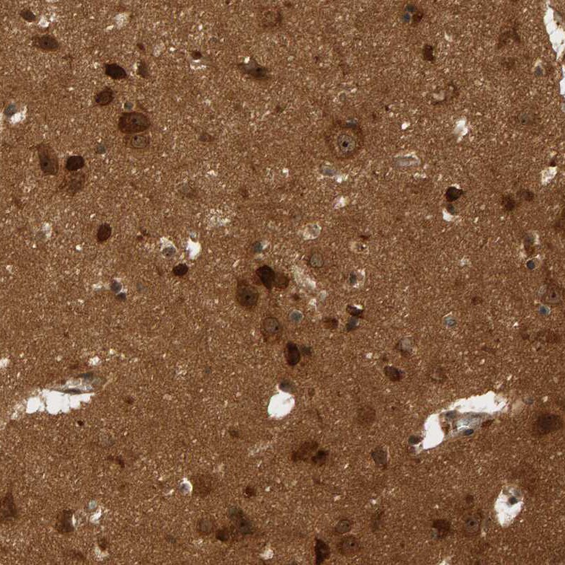 BAHCC1 Antibody - BSA Free Immunohistochemistry: BAHCC1 Antibody - BSA Free [NBP1-91067]