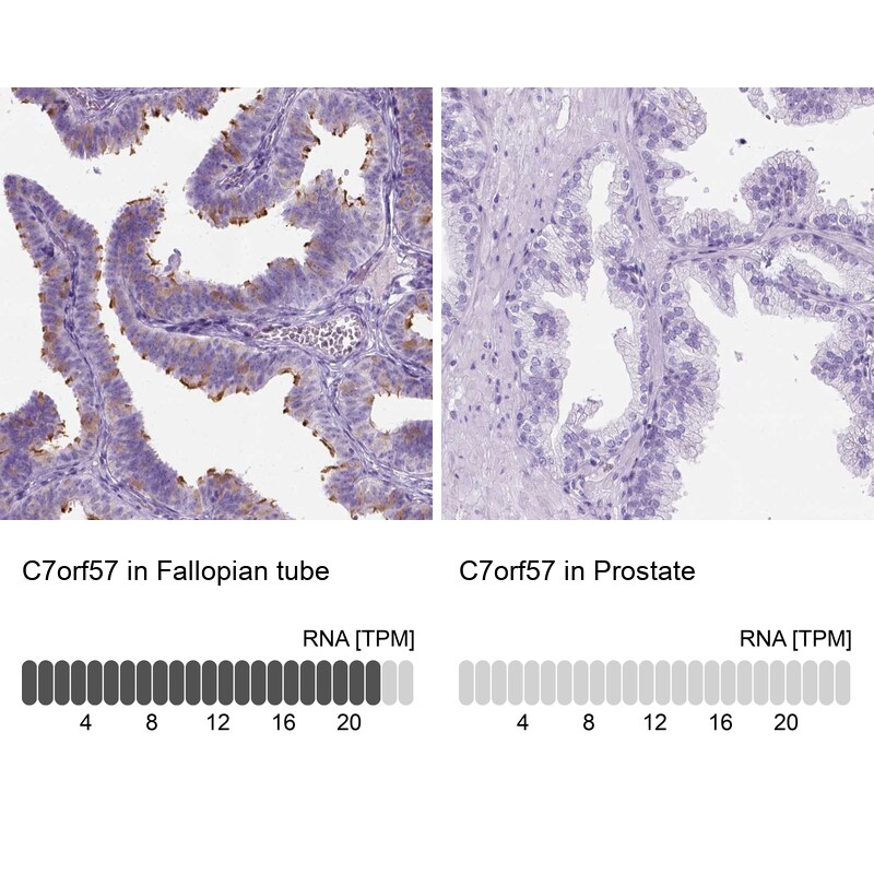 C7orf57 Antibody - BSA Free Immunohistochemistry: C7orf57 Antibody - BSA Free [NBP1-91074]